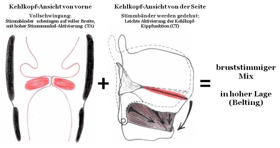 Drawings of laryngeal views